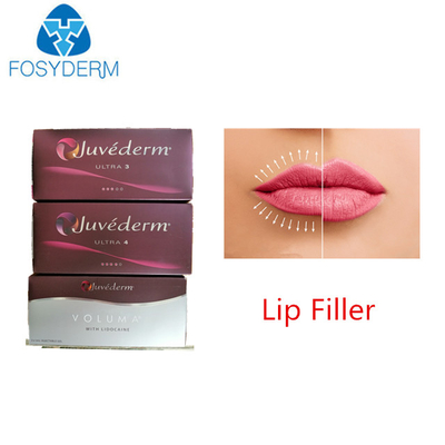Juvederm Hyaluronsäure Hautfüllmittel Anti-Aging Gesichts Lippenfüllmittel 24 mg